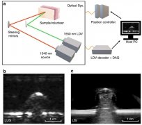 麻省理工学院利用激光超声技术获得首张人类实